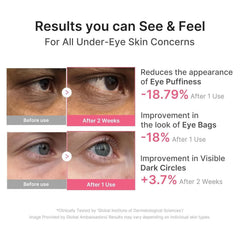 Medicube - PDRN Pink Caffeine Collagen Eye Patches